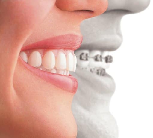 Cosmetic Dentistry, Thamesmead