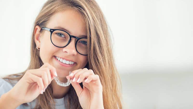 Clear braces