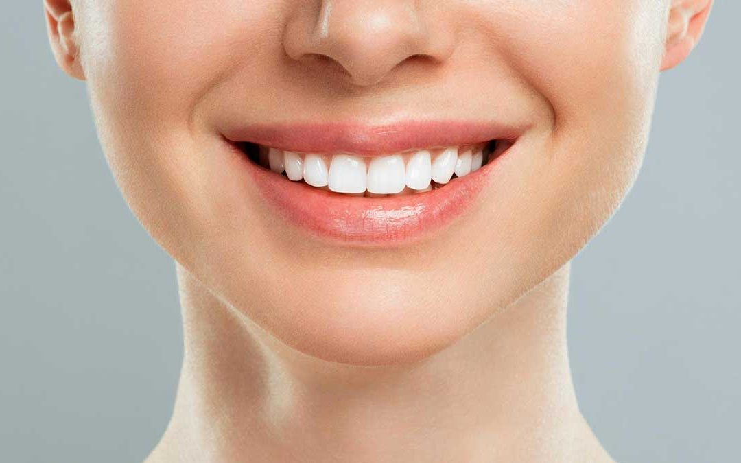 Align, Bleach and Bond (ABB) Explained